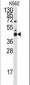 Bcl-G BH3 Domain Antibody